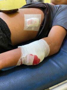 Naas!!! Bertamu ke Hotel Tengah Malam, Pemuda Ditikam Sajam