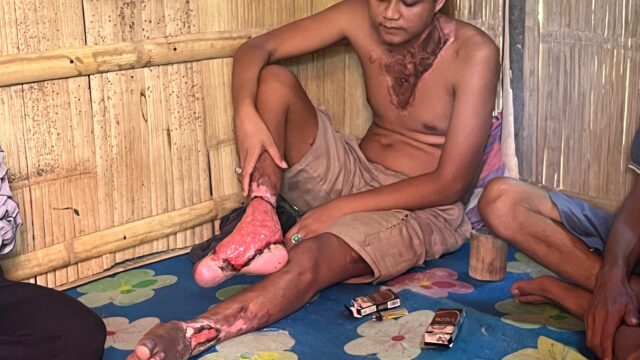 “Kapolres Kepahiang Tunjukkan Empati Nyata, Bantu Korban Sengatan Listrik Bangkit dari Keterpurukan”